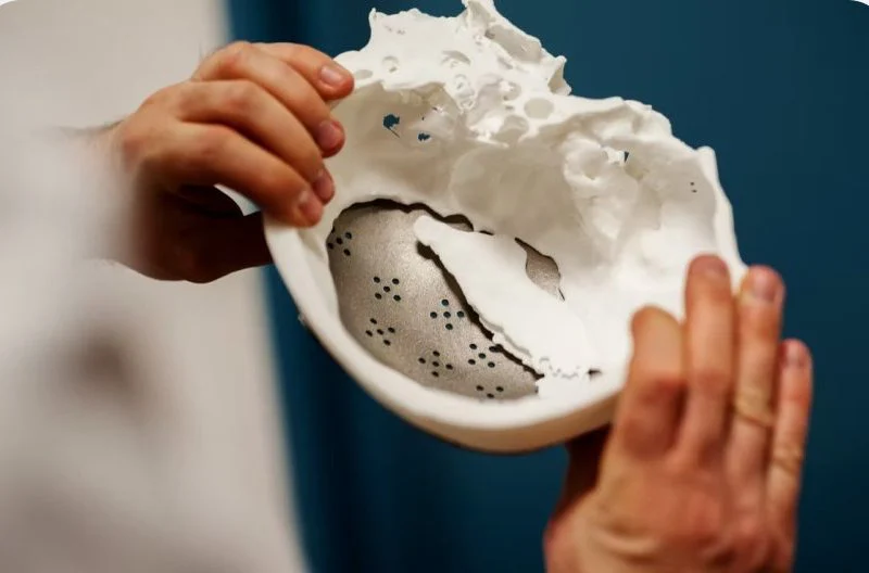 Hands holding a printed cranial plate