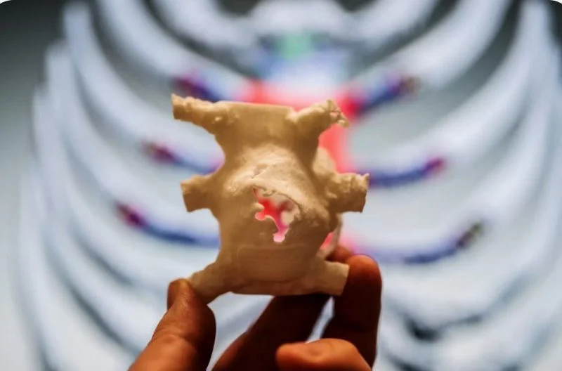 A printed sternum model held in front of a rib cage